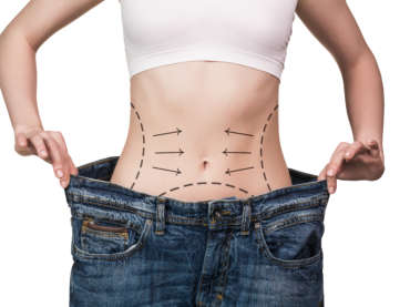 Abdominoplastie en Tunisie